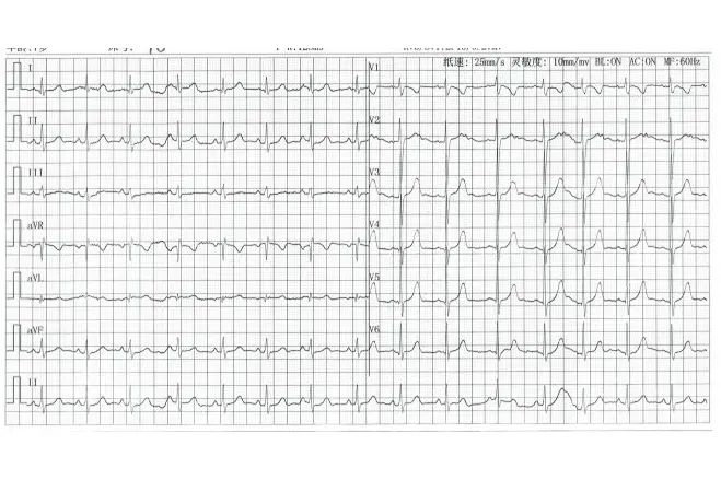 Siguang Mingyang1yyb