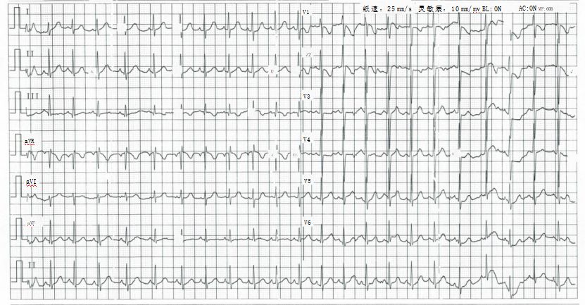 Due to premature birth and treatment in an incubator, the child's birth weight was only 1500 grams4ba