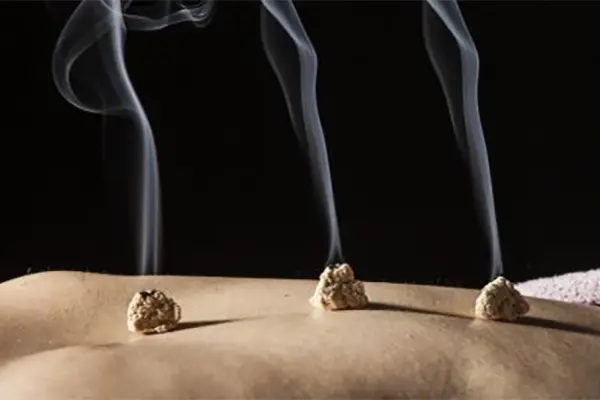 Traditional Chinese Medicine (2)-2ffh